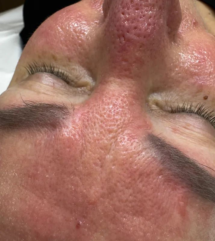 alchemiapiękna-przed2