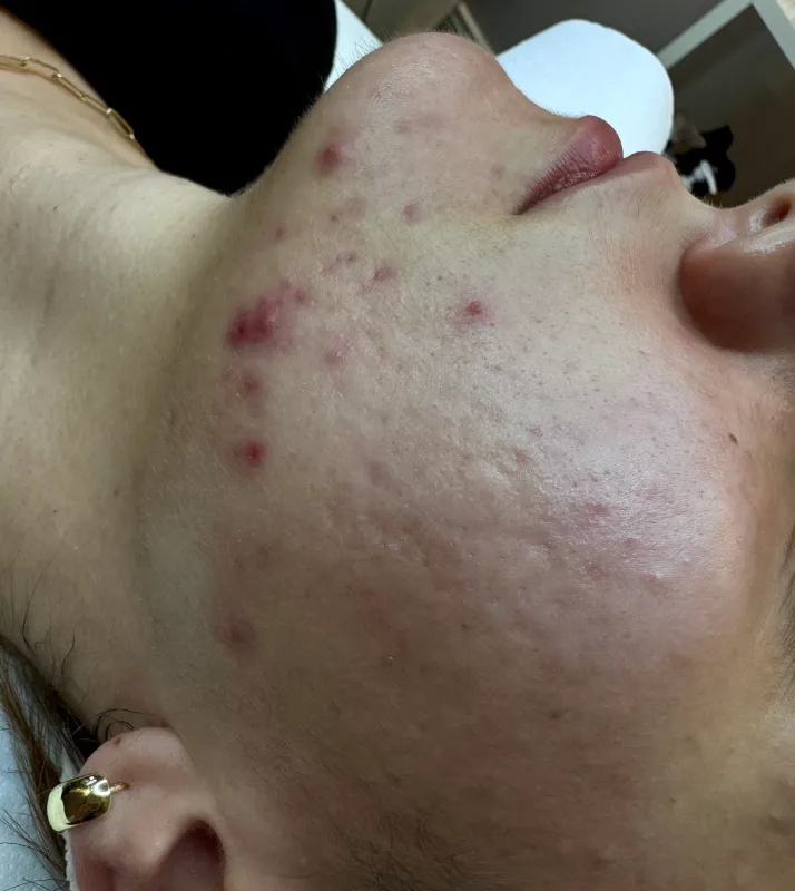 alchemiapiękna-przed3